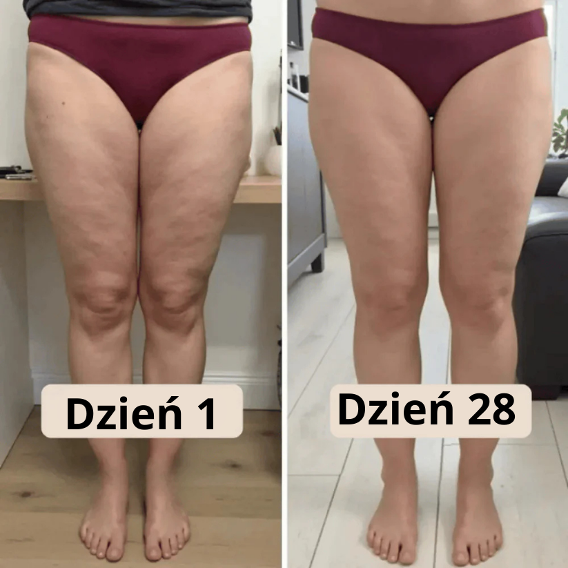 Modelujące Krótkie Legginsy – Zmień swoją sylwetkę bez wysiłku